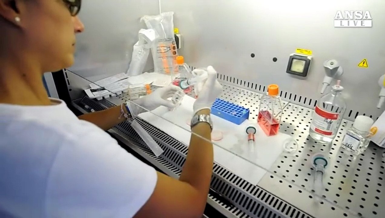 Leucemia mieloide acuta, un test sangue per predirla