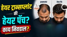 हेयर ट्रान्सप्लांट की हेअर पॅच? कोणता ऑप्शन बेस्ट? | Hair Transplant Vs Hair Patch