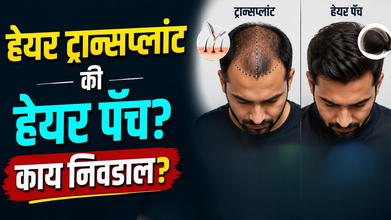 हेयर ट्रान्सप्लांट की हेअर पॅच? कोणता ऑप्शन बेस्ट? | Hair Transplant Vs Hair Patch