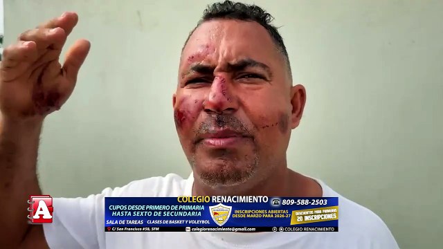 Conductor se da a la fuga tras atropellar motociclista en SFM