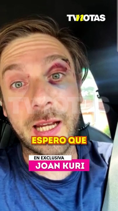 ¿El violentador estaba bajo sustancias? Joan Kuri espera que el agresor no quede impune
