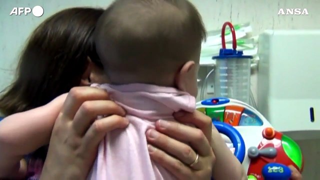 Pediatrie sono in affanno in molte realta' d'Italia per le tante infezioni da virus respiratori nei bambini