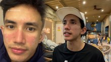 Muka merah dan kulit mengelupas, Imran Aqil hampir tinggalkan dunia seni