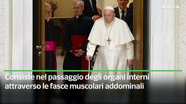 Ecco l'ernia di cui soffre papa Francesco