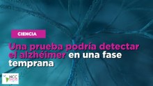 Una prueba podría detectar el alzhéimer en una fase temprana