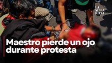 Miembro de la CNTE pierde el ojo tras impacto de petardo