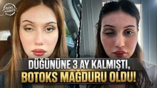 Botoks yaptıran kadının işlem sonrası göz kapağı düştü