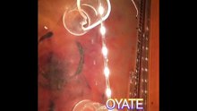 Frosted Tube Infrared Heat Lamps 430mm 90v 300w for Medical Konica Minolta Regius 110 Machine