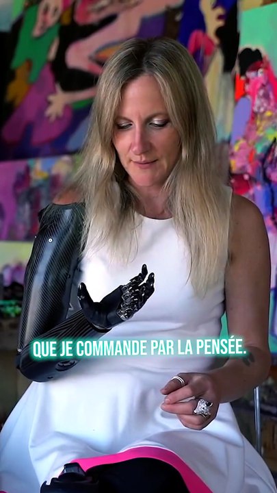 Elle a un bras bionique ! (il coûte 160’000€) 😮