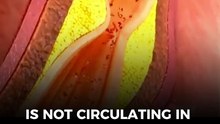 So tell me… are you cutting fat for nothing?