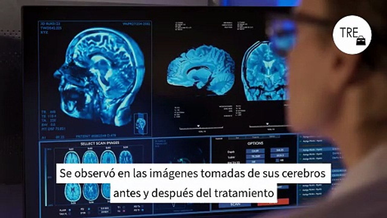 El nuevo e imprevisto efecto secundario de Ozempic que desconcierta a los médicos y que puede modificar la conducta de los usuarios: "No sabemos qué significa"