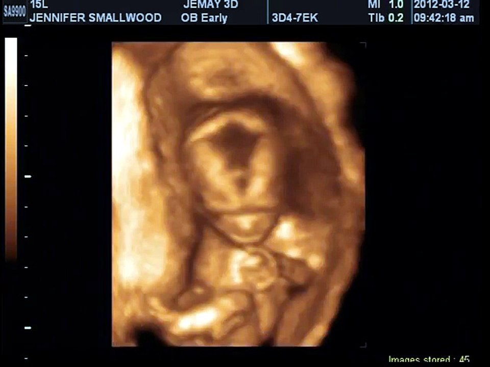 LOGAN MICHAEL XAVIER 3D SONOGRAM MARCH 12 2012