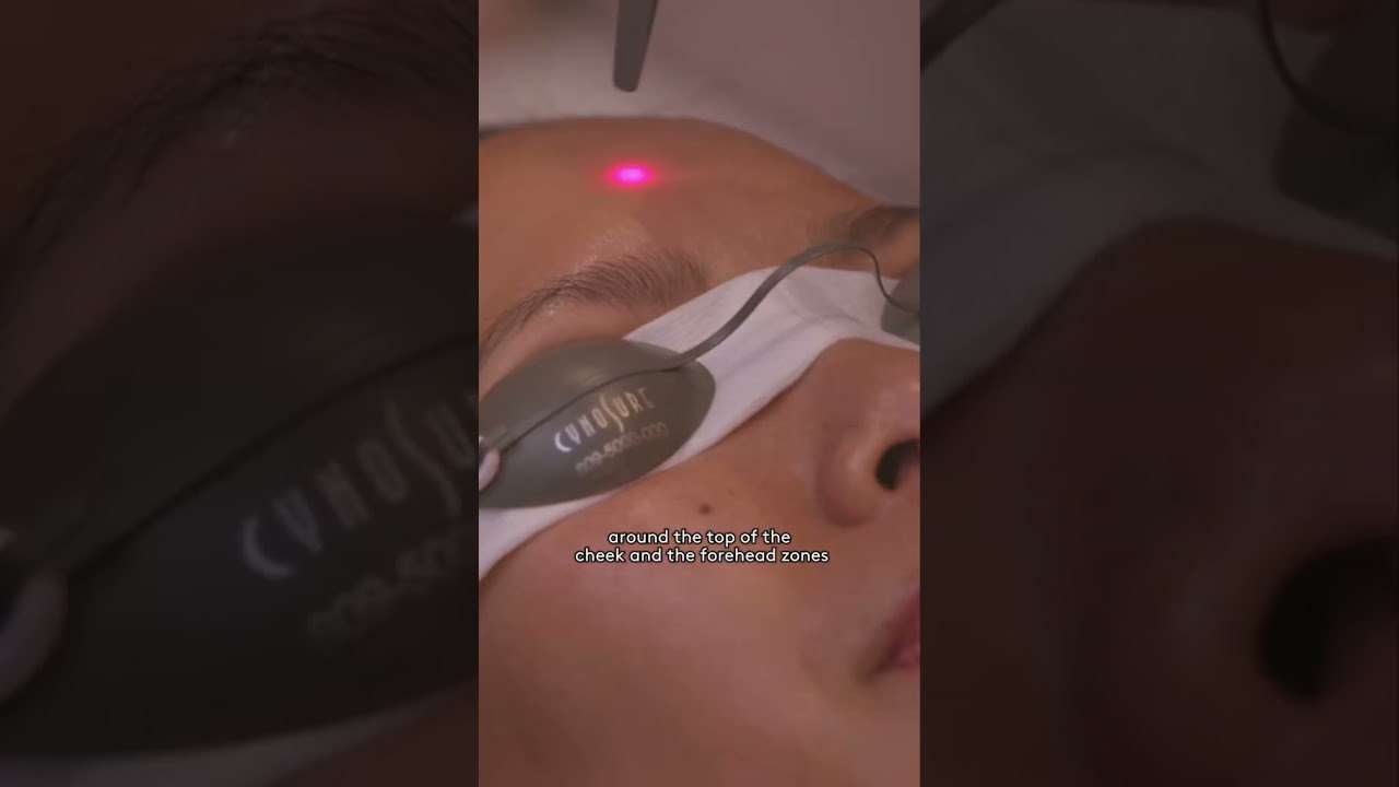 Testing out the #picosure laser! Would you try it?