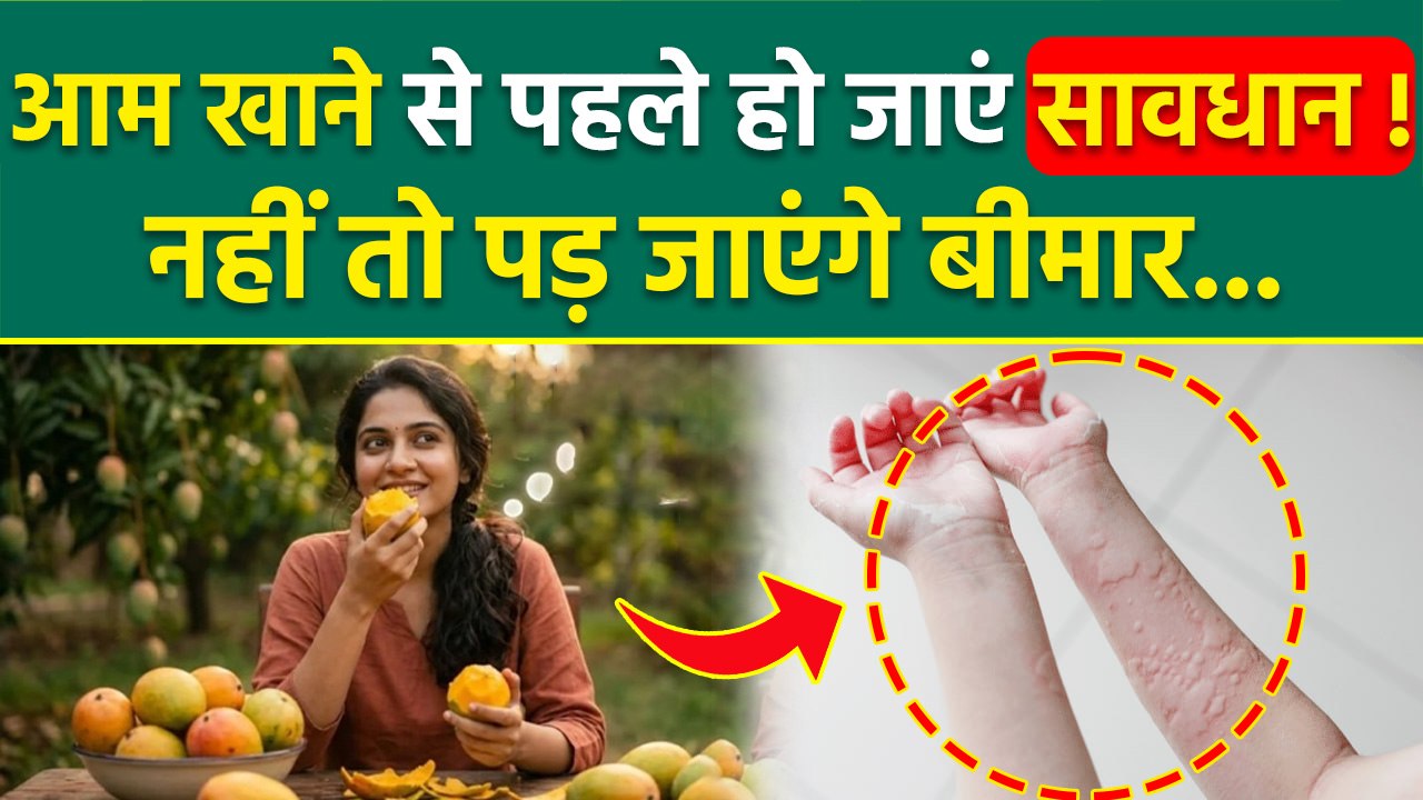 Mango Side Effects: गर्मियों में आप भी खाते हैं ज्यादा आम खाने तो हो जाएं सावधान,Pimple,Rashes...