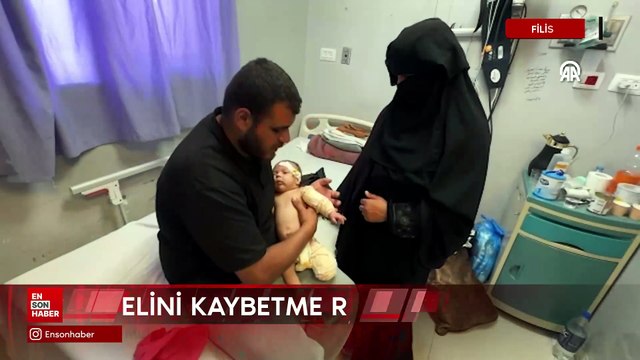 Gazze'de bacağı ampute edilen Muhammed bebek, şimdi de elini kaybedebilir