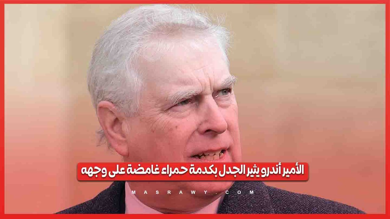الأمير أندرو يثير الجدل بكدمة حمراء غامضة على وجهه