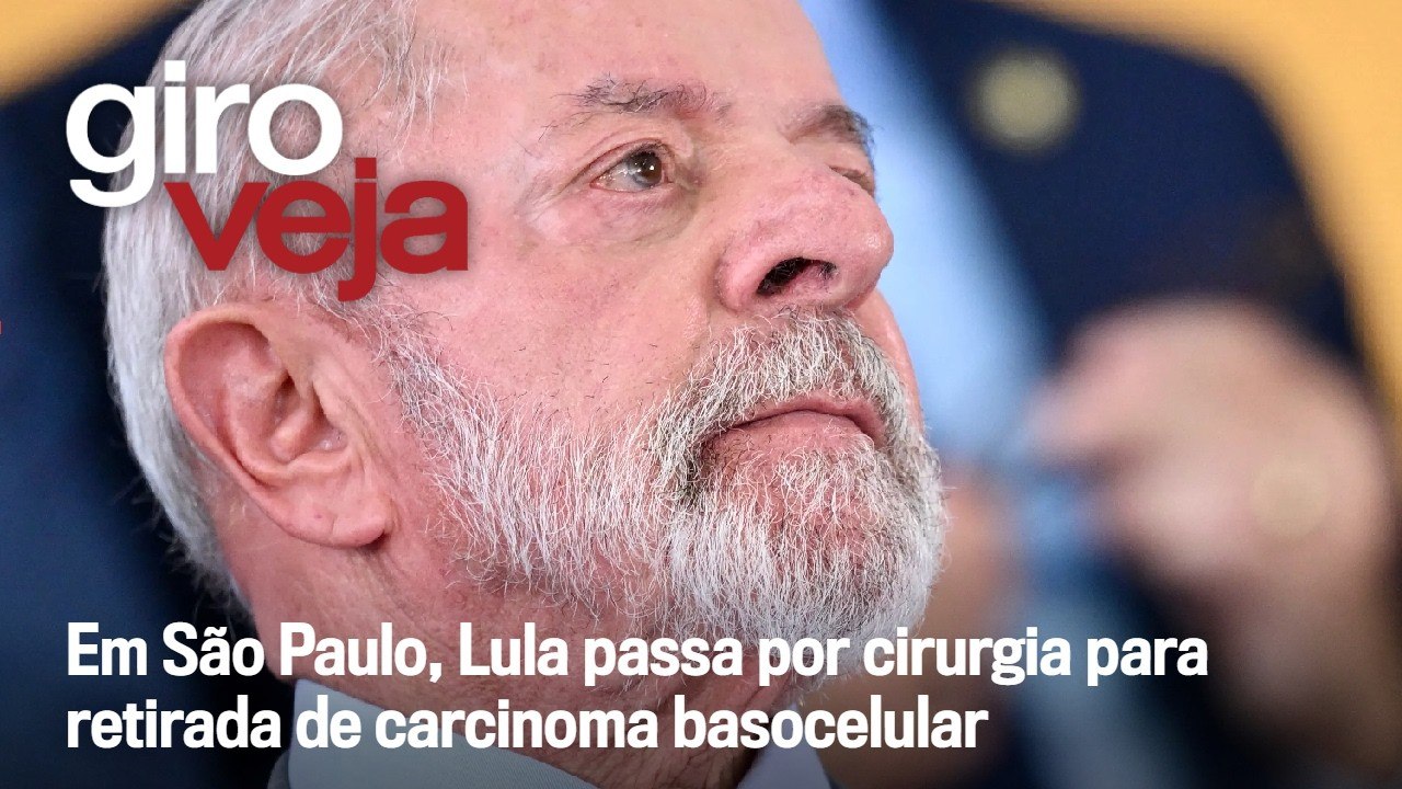 Lula passa por cirurgia para retirada de carcinoma basocelular | Giro VEJA