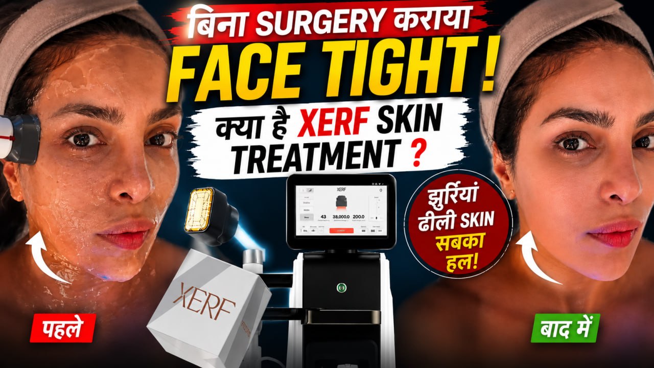 Priyanka Chopra का Viral XERF Treatment क्या है ? Without Surgery Skin Tight करने का New Trend, Cost