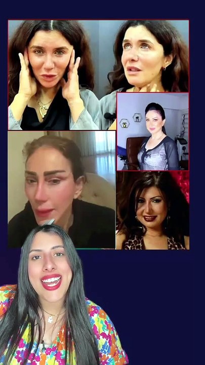 غادة عادل مش الوحيدة ... أربع فنانات التجميل جاب معاهم نتيجة عكسية وسبب لهم مشاكل