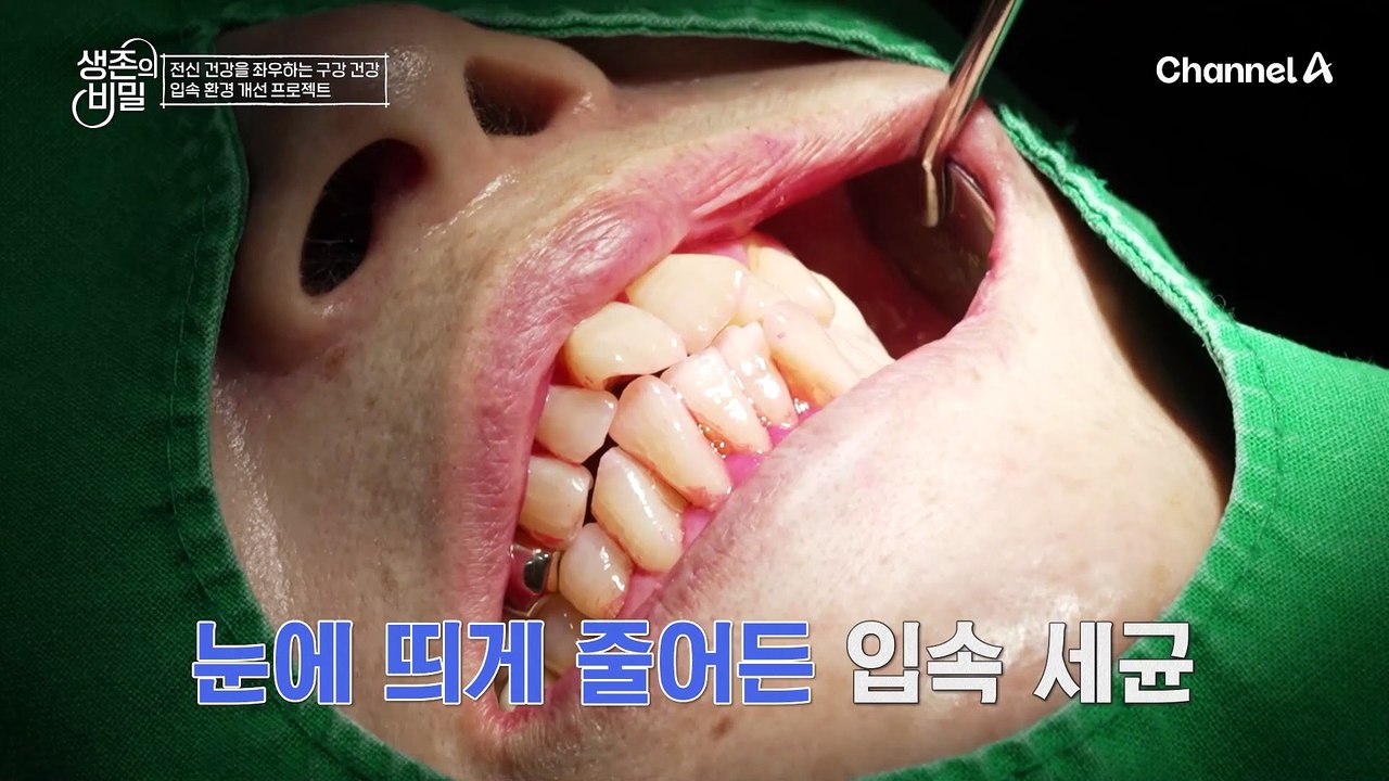 최대 99.9% 억제에 도움! 구강 유산균 M18이 구강 세균에 미치는 영향