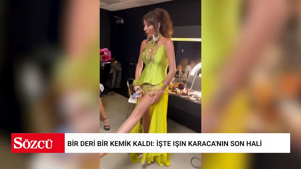 Bir deri bir kemik kaldı: İşte Işın Karaca'nın son hali