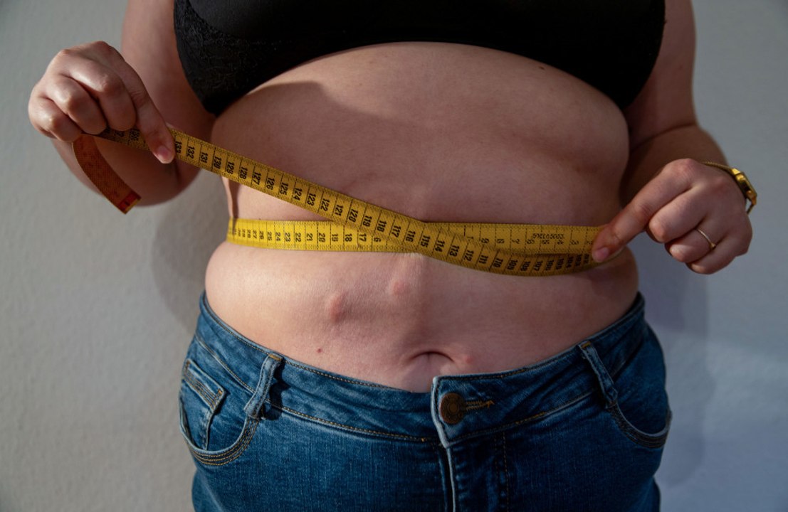 A daily weight-loss pill shows significant weight loss and blood sugar improvements