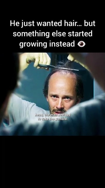 He just wanted hair… but something else started growing instead 👁️