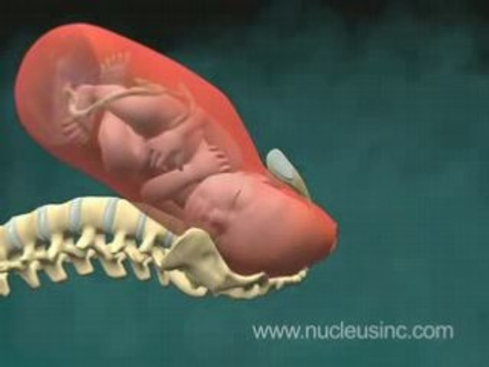ACCOUCHEMENT EN 3D