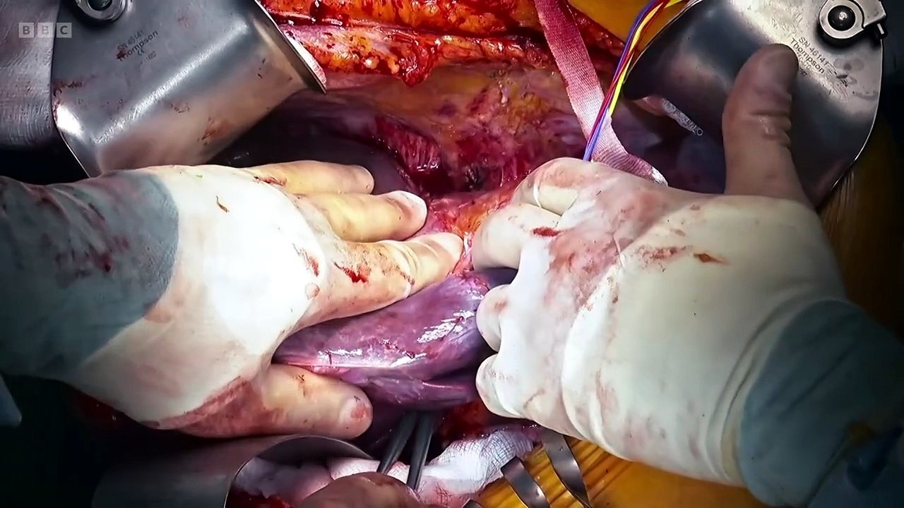 Surgeons At the Edge of Life S08E06 One False M...