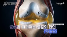 [예고] 무릎에서 시작된 염증의 불씨♨ 일상을 파괴하는 통증! 관절염에서 벗어나는 방법은?