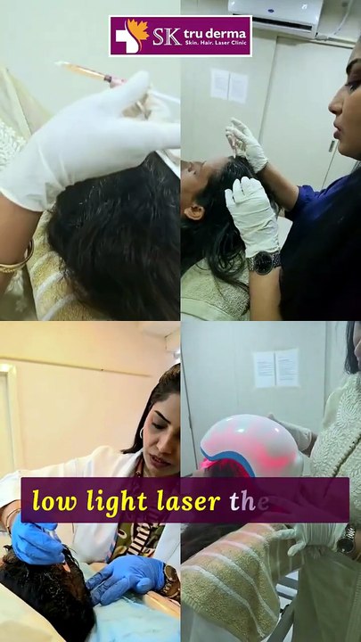 Hair Loss? | Don't Wait Until It's Too Late! | Hair Transplantation in Bangalore