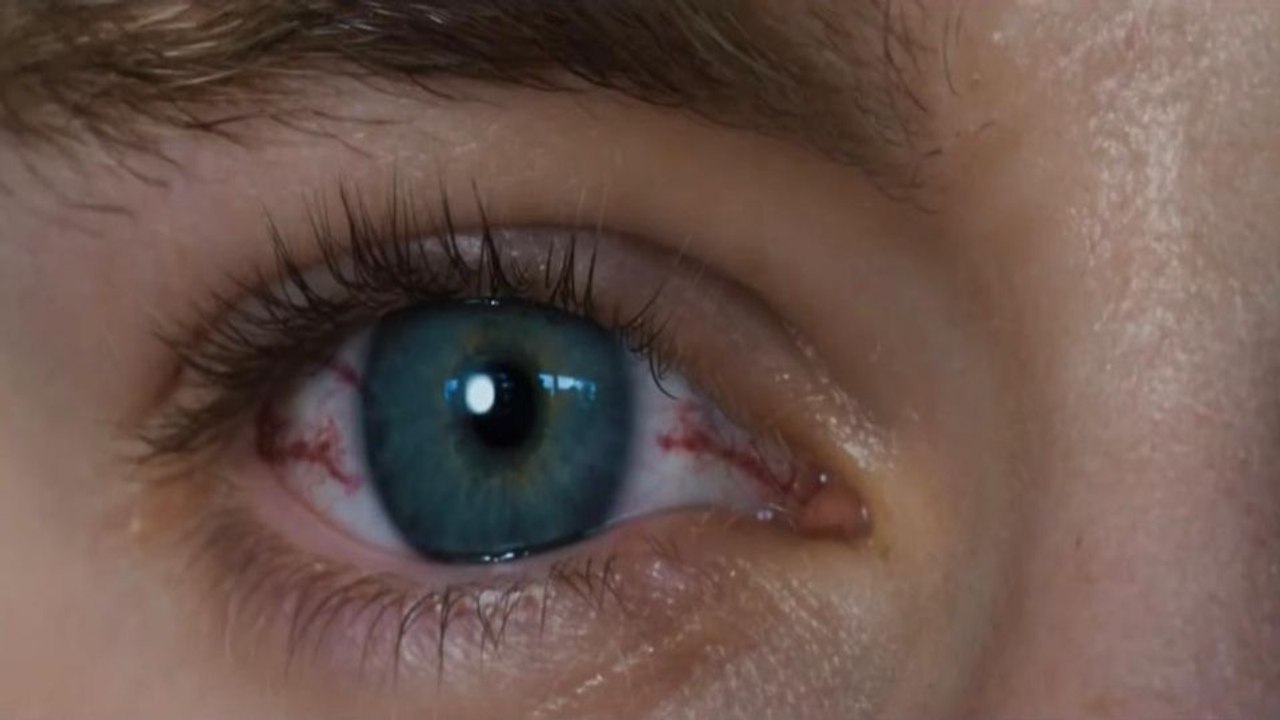 Sanguine Teaser Original