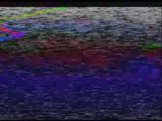 Limp Bizkit - Poop Dvd Pt.4/4