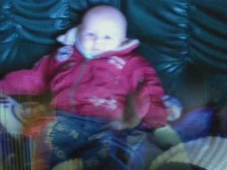 Mathys montage fini