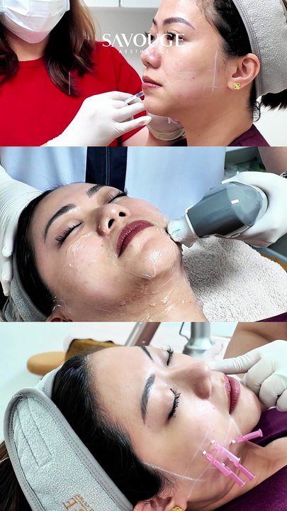 KAREEN SLIM FACE TRIO
