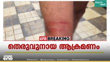വാർഡ് കൗൺസിലറുടെ ഭർത്താവ് അടക്കം 3 പേരെ അക്രമിച്ച് തെരുവുനായ | Stray Dog Attack | Palakkad