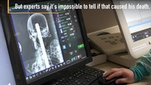 X-Rays Reveal Mummy Was A Teenager