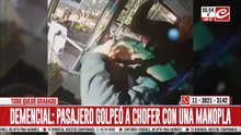 Se enojó con el chofer y le destrozó la cara con una manopla