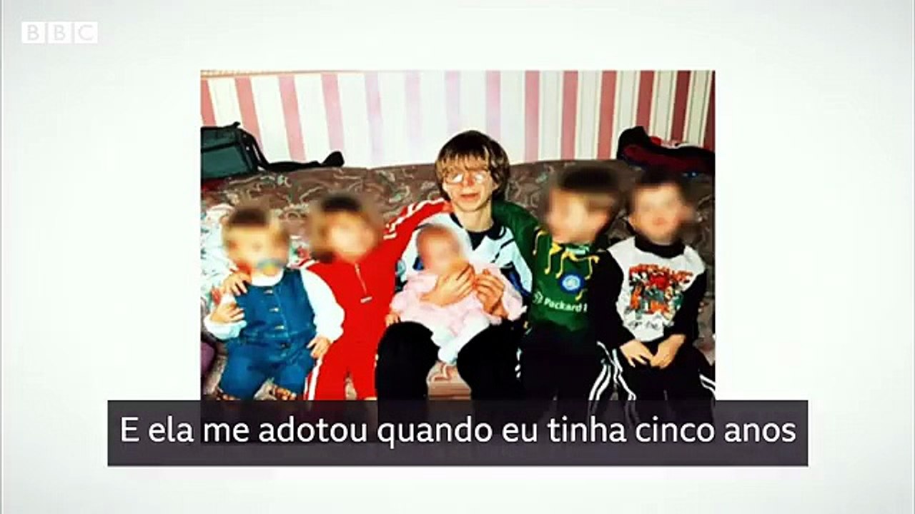 Síndrome de Treacher Collins: 'Odiava o meu rosto, mas agora tenho orgulho dele'