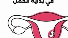الدليل الطبي للتعامل مع حدوث الحمل في وجود اللولب