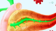 Nuevo tratamiento duplica la supervivencia en cáncer de páncreas