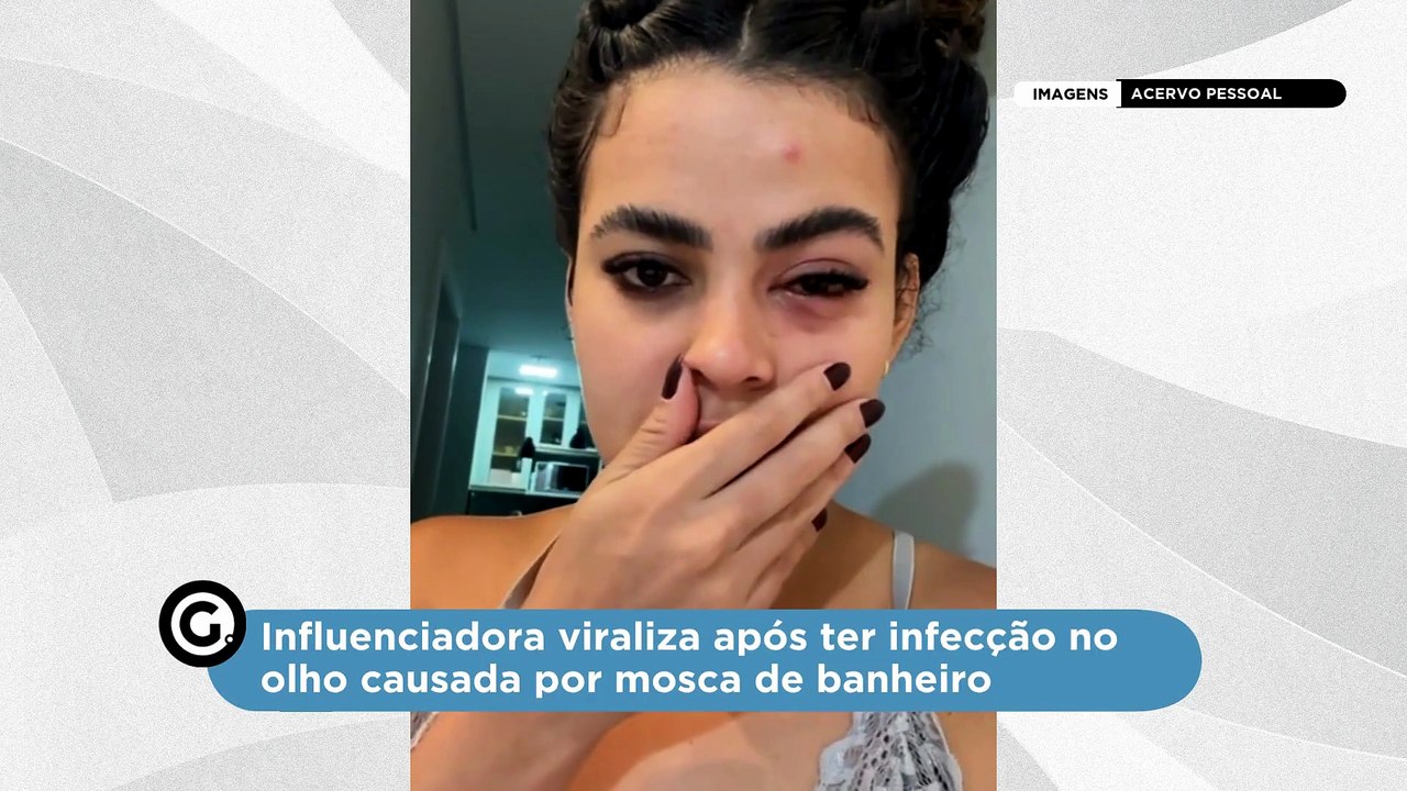 Influenciadora viraliza após ter infecção no olho causada por mosca de banheiro