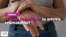 ¿Cómo identificar la artritis reumatoide?