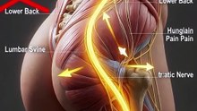 stretching your sciatica