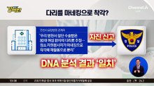 [돌직구 강력반]‘잘린 다리를 마네킹 착각’…수술실 없는데 다리 절단 수술?