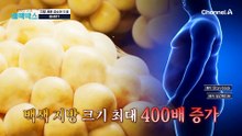 최대 400배 증가?! 내장 지방으로 쌓인 백색 지방 크기를 줄이는게 중요!