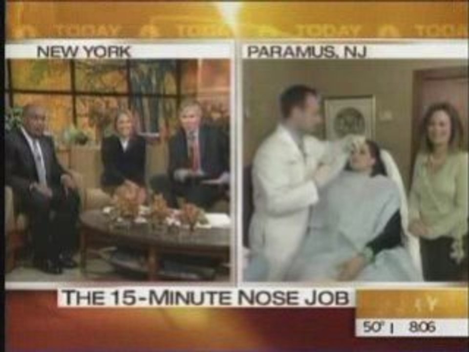 Non Surgical Rhinoplasty by Dr. Alexander Rivkin