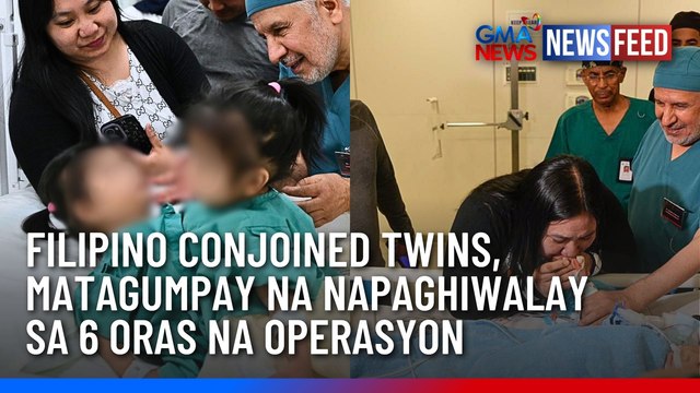 Filipino conjoined twins, matagumpay na napaghiwalay sa 6 oras na operasyon | GMA News Feed