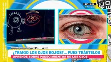 ¿Qué son las 'perrillas' en los ojos?
