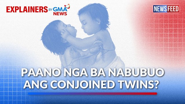 Paano nga ba nabubuo ang conjoined twins? | GMA News Feed